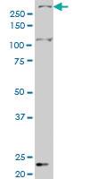 Anti-SMG1 Mouse Monoclonal Antibody [clone: 1C12]