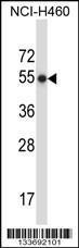 Anti-MMP8 Rabbit Polyclonal Antibody