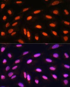 Immunofluorescence analysis of U2OS cells using Anti-KAT2B / PCAF Antibody (A8349) at a dilution of 1:100. DAPI was used to stain the cell nuclei (blue).