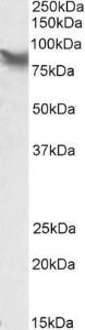 Anti-LPP Antibody (A84745) (0.1 µg/ml) staining of HepG2 lysate (35 µg protein in RIPA buffer). Primary incubation was 1 hour. Detected by chemiluminescence