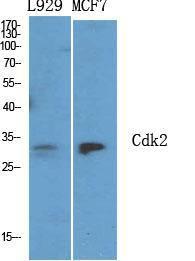 Immunohistochemical analysis of paraffin-embedded human uterus tissue using Anti-CDK2 Antibody at 1:200 (4 °C overnight). Negative control was secondary Antibody only