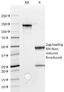 SDS-PAGE analysis of Anti-ROR2 Antibody [ROR2/1912] under non-reduced and reduced conditions; showing intact IgG and intact heavy and light chains, respectively. SDS-PAGE analysis confirms the integrity and purity of the antibody