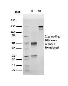 Antibody anti-NKX31 RNKX316620 100 µg