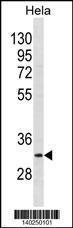 Anti-BRMS1 Rabbit Polyclonal Antibody (Biotin)