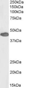 Anti-PAX3 Antibody (A83150/Biotin) (0.5 µg/ml) staining of Human Duodenum lysate (35 µg protein in RIPA buffer)