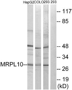 Western blot analysis of lysates from 293, HepG and COLO cells using Anti-MRPL10 Antibody. The right hand lane represents a negative control, where the antibody is blocked by the immunising peptide