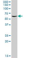 Anti-PSMD5 Rabbit Polyclonal Antibody