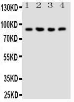 Anti-NRG2 Rabbit Polyclonal Antibody