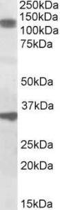 Anti-CCAR1 Antibody (A84746) (1µg/ml) staining of Rat Skeletal Muscle lysate (35µg protein in RIPA buffer). Primary incubation was 1 hour. Detected by chemiluminescence.