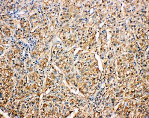 Anti-Kallistatin Rabbit Polyclonal Antibody