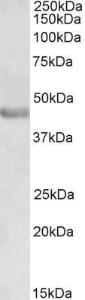 Anti-PAX3 Antibody (A83151) (0.3µg/ml) staining of Human Duodenum lysate (35µg protein in RIPA buffer). Detected by chemiluminescence.