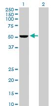 Anti-PSMD5 Rabbit Polyclonal Antibody