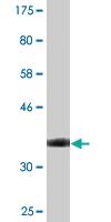 Anti-STAB1 Mouse Monoclonal Antibody [clone: 4G9]