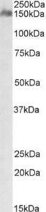 Anti-CSMD1 Antibody (A84747) (1µg/ml) staining of Human Cerebellum lysate (35µg protein in RIPA buffer). Primary incubation was 1 hour. Detected by chemiluminescence.