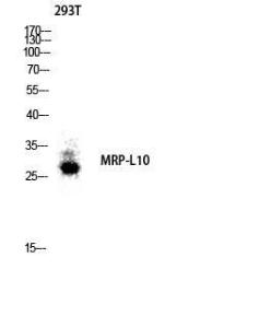 Western blot analysis of 293T lysis using Anti-MRPL10 Antibody