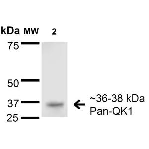 Anti-QKI Mouse Monoclonal Antibody [Clone: S147-6]