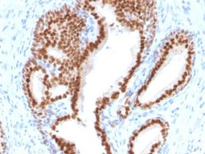 Anti-NKX31 antibody