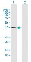 Anti-ACVR2B Mouse Polyclonal Antibody