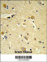 Anti-CDIPT Rabbit Polyclonal Antibody (PE (Phycoerythrin))