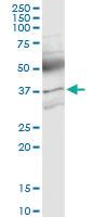 Anti-ACVR2B Rabbit Polyclonal Antibody