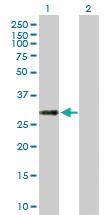 Anti-ERP27 Mouse Polyclonal Antibody