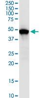 Anti-SKP2 Polyclonal Antibody Pair