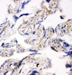 Anti-SNAP23 Rabbit Polyclonal Antibody