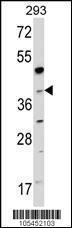 Anti-NAGK Rabbit Polyclonal Antibody (FITC (Fluorescein Isothiocyanate))