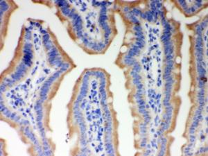 Anti-ITPR3 Rabbit Polyclonal Antibody