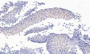 Anti-PAX3 Antibody (A83151) (4.5µg/ml) staining of paraffin embedded Human Esophagus. Heat induced antigen retrieval with citrate buffer pH 6, HRP-staining.