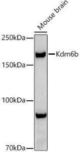 Anti-KDM6B/JMJD3 Rabbit Polyclonal Antibody