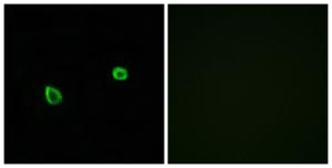 Anti-ERN2 antibody