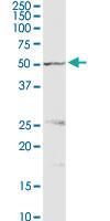 Anti-PSMD5 Rabbit Polyclonal Antibody