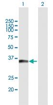 Anti-TICAM2 Mouse Polyclonal Antibody