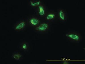 Anti-TPMT Mouse Monoclonal Antibody [clone: 1B5]