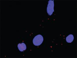 Anti-STAT5A + SHC1 Antibody Pair