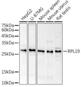 Western blot analysis of extracts of various cell lines, using Anti-RPL19 Antibody (A307804) at 1:1,000 dilution