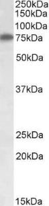 Anti-RARS antibody