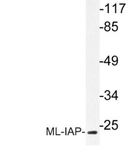 Western blot analysis of lysate from COLO cells using Anti-ML-IAP Antibody