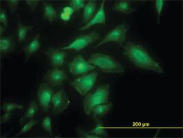 Anti-TRAPPC4 Mouse Monoclonal Antibody [clone: 2D10]