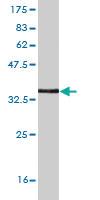 Anti-ZKSCAN7 Mouse Monoclonal Antibody [clone: 3A12]