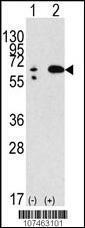 Anti-BECN1 Rabbit Polyclonal Antibody (Biotin)