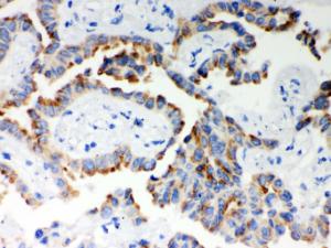 Anti-ITPR3 Rabbit Polyclonal Antibody