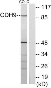 Anti-Cadherin 9 Rabbit Polyclonal Antibody