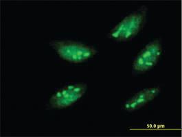 Anti-MEOX1 Mouse Monoclonal Antibody [clone: 1A10]