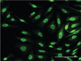 Anti-OXSR1 Mouse Monoclonal Antibody [clone: 4D12]