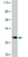 Anti-DNMT1 Mouse Monoclonal Antibody [clone: 2B5]