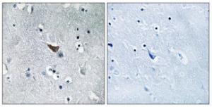 Immunohistochemical analysis of paraffin-embedded human brain tissue using Anti-GluR1 Antibody. The right hand panel represents a negative control, where the Antibody was pre-incubated with the immunising peptide