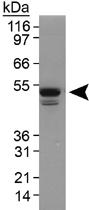 Anti-PLIN3 Rabbit Polyclonal Antibody