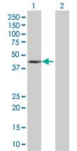 Anti-SAP30BP Mouse Polyclonal Antibody